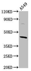 ELMOD3 Antibody - Positive Western Blot detected in A549 whole cell lysate. All lanes: ELMOD3 antibody at 4.3 µg/ml Secondary Goat polyclonal to rabbit IgG at 1/50000 dilution. Predicted band size: 44, 29, 19, 21, 45 KDa. Observed band size: 44 KDa