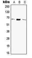 ELN / Elastin Antibody - Western blot analysis of Elastin expression in HEK293T (A); SP2/0 (B); H9C2 (C) whole cell lysates.