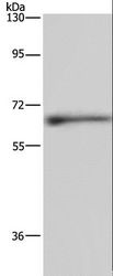 ELN / Elastin Antibody - Western blot analysis of Human hepatocellular carcinoma tissue, using ELN Polyclonal Antibody at dilution of 1:500.