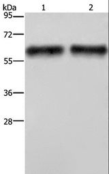ELN / Elastin Antibody - Western blot analysis of Human hepatocellular carcinoma tissue, using ELN Polyclonal Antibody at dilution of 1:400.