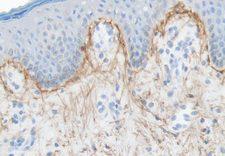 ELN / Elastin Antibody - Elastin on human skin paraffin section DAB, hematoxylin