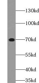 ELN / Elastin Antibody - Mouse lung tissue were subjected to SDS PAGE followed by western blot with ELN antibody at dilution of 1:500