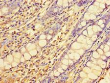 ELOVL1 Antibody - Immunohistochemistry of paraffin-embedded human colon tissue using ELOVL1 Antibody at dilution of 1:100
