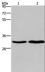 ELOVL1 Antibody - Western blot analysis of HeLa and A375 cell, using ELOVL1 Polyclonal Antibody at dilution of 1:550.