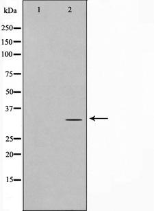 ELOVL1 Antibody - Western blot analysis on Jurkat cell lysates using ELOVL1 antibody. The lane on the left is treated with the antigen-specific peptide.