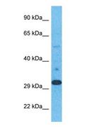 ELOVL1 Antibody - Western blot of ELOV1 Antibody with human Stomach Tumor lysate.  This image was taken for the unconjugated form of this product. Other forms have not been tested.