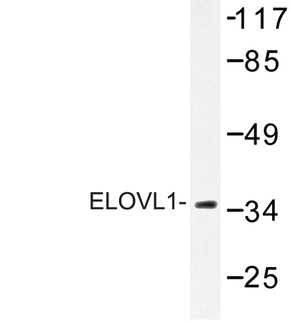 ELOVL1 Antibody - Western blot of ELOVL1 (F139) pAb in extracts from Jurkat cells.