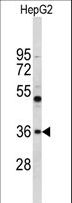 ELOVL2 Antibody - Western blot of ELOVL2 Antibody in HepG2 cell line lysates (35 ug/lane). ELOVL2 (arrow) was detected using the purified antibody.