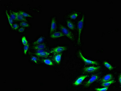 ELOVL2 Antibody - Immunofluorescent analysis of HepG2 cells using ELOVL2 Antibody at dilution of 1:100 and Alexa Fluor 488-congugated AffiniPure Goat Anti-Rabbit IgG(H+L)