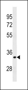 ELOVL3 Antibody - ELOVL3 Antibody western blot of A2058 cell line lysates (35 ug/lane). The ELOVL3 antibody detected the ELOVL3 protein (arrow).