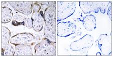 ELOVL3 Antibody - Immunohistochemistry analysis of paraffin-embedded human placenta, using ELOVL3 Antibody. The picture on the right is blocked with the synthesized peptide.