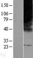 ELOVL3 Protein - Western validation with an anti-DDK antibody * L: Control HEK293 lysate R: Over-expression lysate