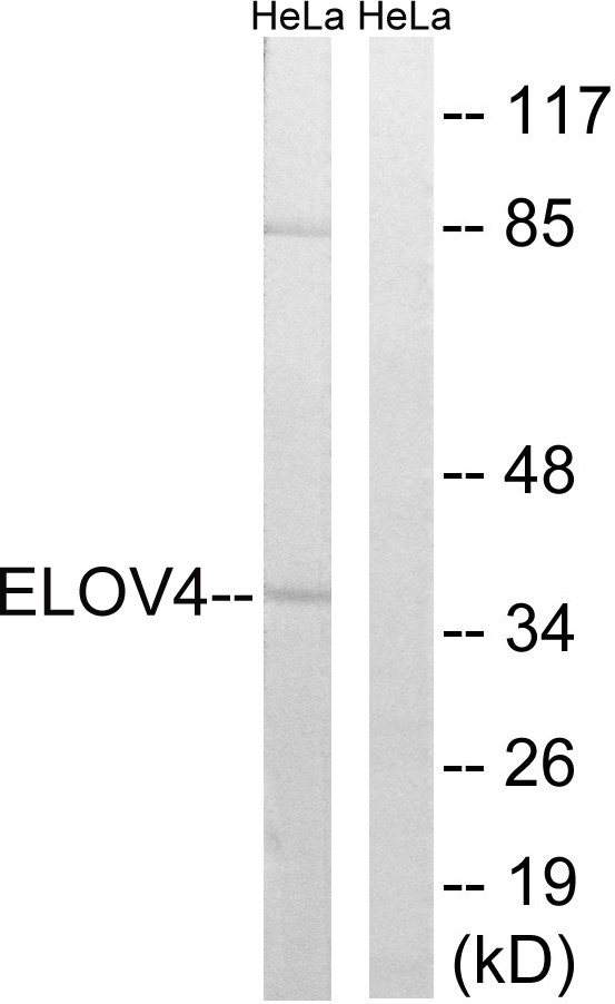 ELOVL4 Antibody - Western blot analysis of lysates from HeLa cells, using ELOVL4 Antibody. The lane on the right is blocked with the synthesized peptide.