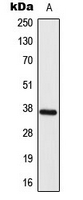 ELOVL4 Antibody - Western blot analysis of ELOVL4 expression in HY926 (A) whole cell lysates.