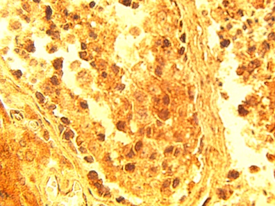 ELOVL4 Antibody - IHC of normal human testis tissue using ELOV4 antibody at 15 ug/ml.