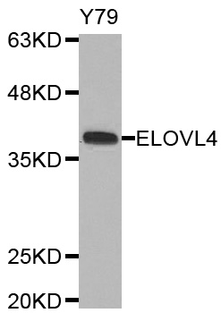 ELOVL4 Antibody - Western blot analysis of extracts of Y79 cells.