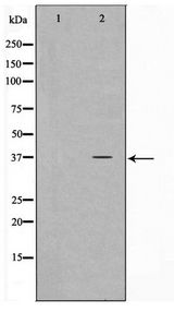 ELOVL4 Antibody - Western blot of HeLa cell lysate using ELOVL4 Antibody