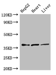 ELOVL4 Antibody - Positive WB detected in:HepG2 whole cell lysate,Rat heart tissue,Rat liver tissue;All lanes:ELOVL4 antibody at 3?g/ml;Secondary;Goat polyclonal to rabbit IgG at 1/50000 dilution;Predicted band size: 37 KDa;Observed band size: 37 KDa;