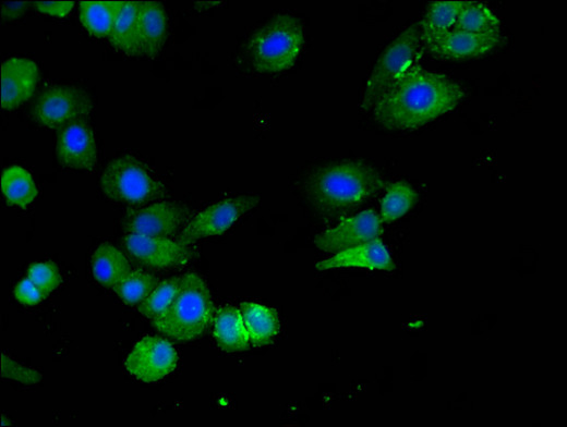 ELOVL4 Antibody - Immunofluorescent analysis of HepG2 cells using ELOVL4 Antibody at a dilution of 1:100 and Alexa Fluor 488-congugated AffiniPure Goat Anti-Rabbit IgG(H+L)
