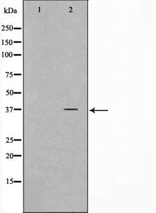 ELOVL4 Antibody - Western blot analysis on HeLa cell lysates using ELOVL4 antibody. The lane on the left is treated with the antigen-specific peptide.
