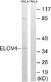 ELOVL4 Antibody - Western blot analysis of extracts from HeLa cells, using ELOVL4 antibody.