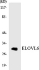 ELOVL6 Antibody - Western blot analysis of the lysates from K562 cells using ELOVL6 antibody.