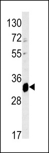 ELOVL6 Antibody - Western blot of ELOVL6 antibody in mouse liver tissue lysates (35 ug/lane). ELOVL6 (arrow) was detected using the purified antibody.