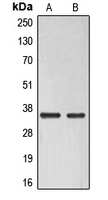 ELOVL6 Antibody - Western blot analysis of ELOVL6 expression in Raji (A); HUVEC (B) whole cell lysates.