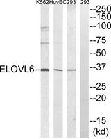 ELOVL6 Antibody - Western blot analysis of extracts from 293, HuvEc and K562 cells, using ELOVL6 antibody.