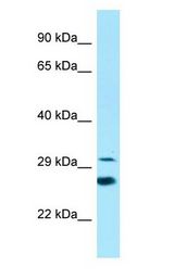 ELOVL6 Antibody - ELOVL6 antibody Western Blot of Placenta.  This image was taken for the unconjugated form of this product. Other forms have not been tested.