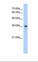 ELOVL7 Antibody - HepG2 cell lysate. Antibody concentration: 1.25 ug/ml. Gel concentration: 12%.  This image was taken for the unconjugated form of this product. Other forms have not been tested.
