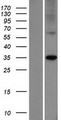 ELOVL7 Protein - Western validation with an anti-DDK antibody * L: Control HEK293 lysate R: Over-expression lysate