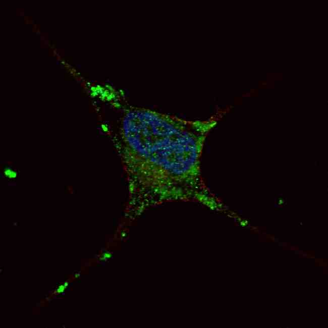ELP2 / STATIP1 Antibody - Fluorescent confocal image of SY5Y cells stained with ELP2 antibody. SY5Y cells were fixed with 4% PFA (20 min), permeabilized with Triton X-100 (0.2%, 30 min). Cells were then incubated ELP2 primary antibody (1:100, 2 h at room temperature). For secondary antibody, Alexa Fluor 488 conjugated donkey anti-rabbit antibody (green) was used (1:1000, 1h). Nuclei were counterstained with Hoechst 33342 (blue) (10 ug/ml, 5 min). Note the highly specific localization of the ELP2 immunosignal mainly to the cytoplasm, supported by Human Protein Atlas Data (http://www.proteinatlas.org/ENSG00000134759).