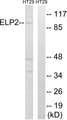 ELP2 / STATIP1 Antibody - Western blot analysis of lysates from HT-29 cells, using ELP2 Antibody. The lane on the right is blocked with the synthesized peptide.