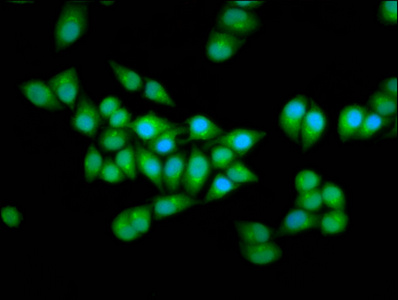 ELP2 / STATIP1 Antibody - Immunofluorescence staining of Hela cells diluted at 1:166, counter-stained with DAPI. The cells were fixed in 4% formaldehyde, permeabilized using 0.2% Triton X-100 and blocked in 10% normal Goat Serum. The cells were then incubated with the antibody overnight at 4°C.The Secondary antibody was Alexa Fluor 488-congugated AffiniPure Goat Anti-Rabbit IgG (H+L).