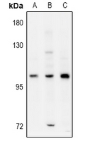 ELP2 / STATIP1 Antibody - Western blot analysis of ELP2 expression in LO2 (A), HEK293T (B), A549 (C) whole cell lysates.