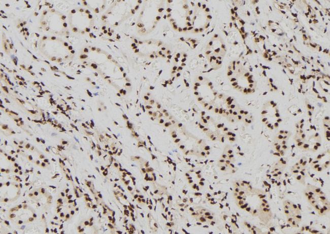 ELP2 / STATIP1 Antibody - 1:100 staining human kidney tissue by IHC-P. The sample was formaldehyde fixed and a heat mediated antigen retrieval step in citrate buffer was performed. The sample was then blocked and incubated with the antibody for 1.5 hours at 22°C. An HRP conjugated goat anti-rabbit antibody was used as the secondary.