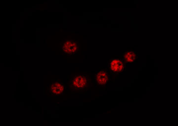 ELP2 / STATIP1 Antibody - Staining HT29 cells by IF/ICC. The samples were fixed with PFA and permeabilized in 0.1% Triton X-100, then blocked in 10% serum for 45 min at 25°C. The primary antibody was diluted at 1:200 and incubated with the sample for 1 hour at 37°C. An Alexa Fluor 594 conjugated goat anti-rabbit IgG (H+L) Ab, diluted at 1/600, was used as the secondary antibody.