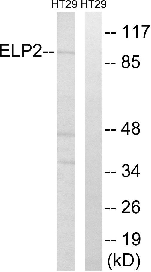 ELP2 / STATIP1 Antibody - Western blot analysis of extracts from HT-29 cells, using ELP2 antibody.