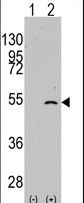 ELP3 Antibody - Western blot of ELP3 (arrow) using rabbit polyclonal ELP3 Antibody. 293 cell lysates (2 ug/lane) either nontransfected (Lane 1) or transiently transfected with the ELP3 gene (Lane 2) (Origene Technologies).