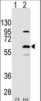 ELP3 Antibody - Western blot of ELP3(arrow) using rabbit polyclonal ELP3 Antibody. 293 cell lysates (2 ug/lane) either nontransfected (Lane 1) or transiently transfected with the ELP3 gene (Lane 2) (Origene Technologies).