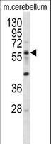 ELP3 Antibody - ELP3 Antibody western blot of mouse cerebellum tissue lysates (35 ug/lane). The ELP3 antibody detected the ELP3 protein (arrow).