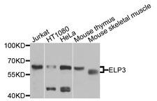 ELP3 Antibody - Western blot analysis of extracts of various cells.