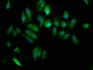 ELP3 Antibody - Immunofluorescence staining of Hela cells at a dilution of 1:133, counter-stained with DAPI. The cells were fixed in 4% formaldehyde, permeabilized using 0.2% Triton X-100 and blocked in 10% normal Goat Serum. The cells were then incubated with the antibody overnight at 4 °C.The secondary antibody was Alexa Fluor 488-congugated AffiniPure Goat Anti-Rabbit IgG (H+L) .
