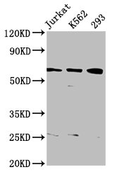 ELP3 Antibody - Positive Western Blot detected in Jurkat whole cell lysate, K562 whole cell lysate, 293 whole cell lysate. All lanes: ELP3 antibody at 3.82 µg/ml Secondary Goat polyclonal to rabbit IgG at 1/50000 dilution. Predicted band size: 63, 61, 50, 53 KDa. Observed band size: 63 KDa