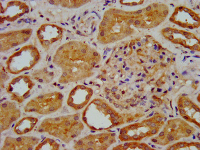ELP3 Antibody - IHC image of ELP3 Antibody diluted at 1:400 and staining in paraffin-embedded human kidney tissue performed on a Leica BondTM system. After dewaxing and hydration, antigen retrieval was mediated by high pressure in a citrate buffer (pH 6.0). Section was blocked with 10% normal goat serum 30min at RT. Then primary antibody (1% BSA) was incubated at 4°C overnight. The primary is detected by a biotinylated secondary antibody and visualized using an HRP conjugated SP system.