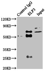 ELP3 Antibody - Immunoprecipitating ELP3 in HEK293 whole cell lysate Lane 1: Rabbit control IgG instead of ELP3 Antibody in HEK293 whole cell lysate.For western blotting, a HRP-conjugated Protein G antibody was used as the secondary antibody (1/2000) Lane 2: ELP3 Antibody (6µg) + HEK293 whole cell lysate (500µg) Lane 3: HEK293 whole cell lysate (20µg)