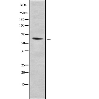 ELP3 Antibody - Western blot analysis of ELP3 using HuvEc whole cells lysates