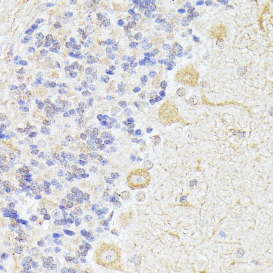 ELP3 Antibody - Immunohistochemistry of paraffin-embedded Rat cerebellum using ELP3 Polyclonal Antibody at dilution of 1:100 (40x lens).