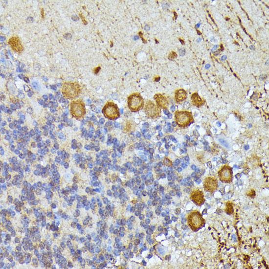 ELP3 Antibody - Immunohistochemistry of paraffin-embedded Mouse cerebellum using ELP3 Polyclonal Antibody at dilution of 1:100 (40x lens).